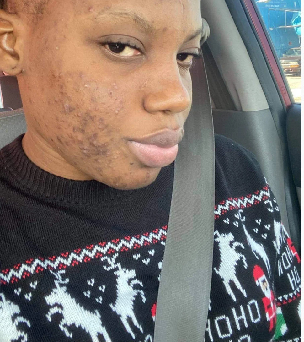 Tumeric Sea Moss MASK ***Best Seller