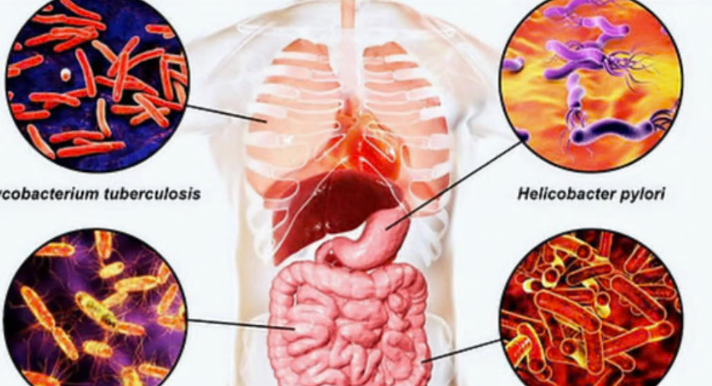Parasite Cleanse Drops